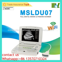 MSLDU07 Prix à la machine à ultrasons par machine à ultrasons Latop économique et à coût élevé